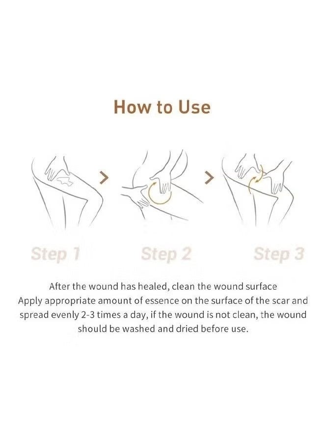 لان بينا جل للعناية بالبشرة ، كريم إصلاح الندبات العشبية 30 جم ، جل ندبات ، جل إصلاح البشرة ، مكونات نباتية طبيعية ، إصلاح الندبات القديمة والجديدة بشكل فعال ، الحروق ، علامات التمدد ، حب الشباب ، حروق الشمس ، 30 جرام - Image 5